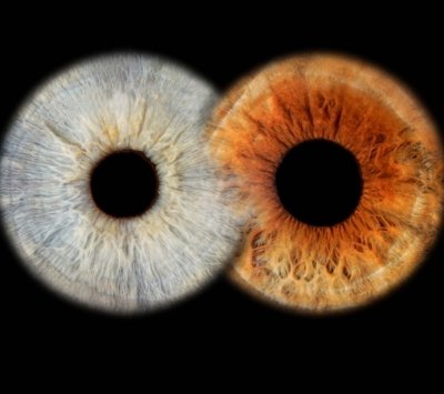 Gran Canaria: Photography of your iris in acrylic printing in 50x50